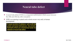 Comprehensive Overview Of Hydrocephalus And Neural Tube Defects comprehensive-overview-of-hydrocephalus-and-neural-tube-defects