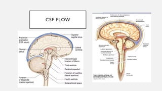 HYDROCEPHALUS final (1) in children. Causes and management | PPTX