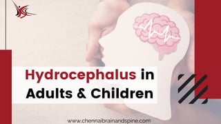 Hydrocephalus in
Adults & Children
www.chennaibrainandspine.com
 