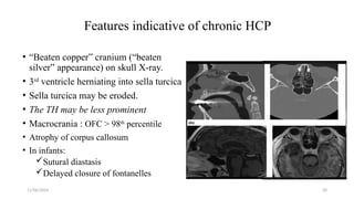 11/06/2024 20
Features indicative of chronic HCP
• “Beaten copper” cranium (“beaten
silver” appearance) on skull X-ray.
• 3rd
ventricle herniating into sella turcica
• Sella turcica may be eroded.
• The TH may be less prominent
• Macrocrania : OFC > 98th
percentile
• Atrophy of corpus callosum
• In infants:
Sutural diastasis
Delayed closure of fontanelles
 