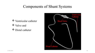 11/06/2024 30
Components of Shunt Systems
 Ventricular catheter
 Valve and
 Distal catheter
 