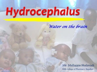 Hydrocephalus
Mr. Mallappa Shalavadi
HSK College of Pharmacy, Bagalkot
Water on the brain
 