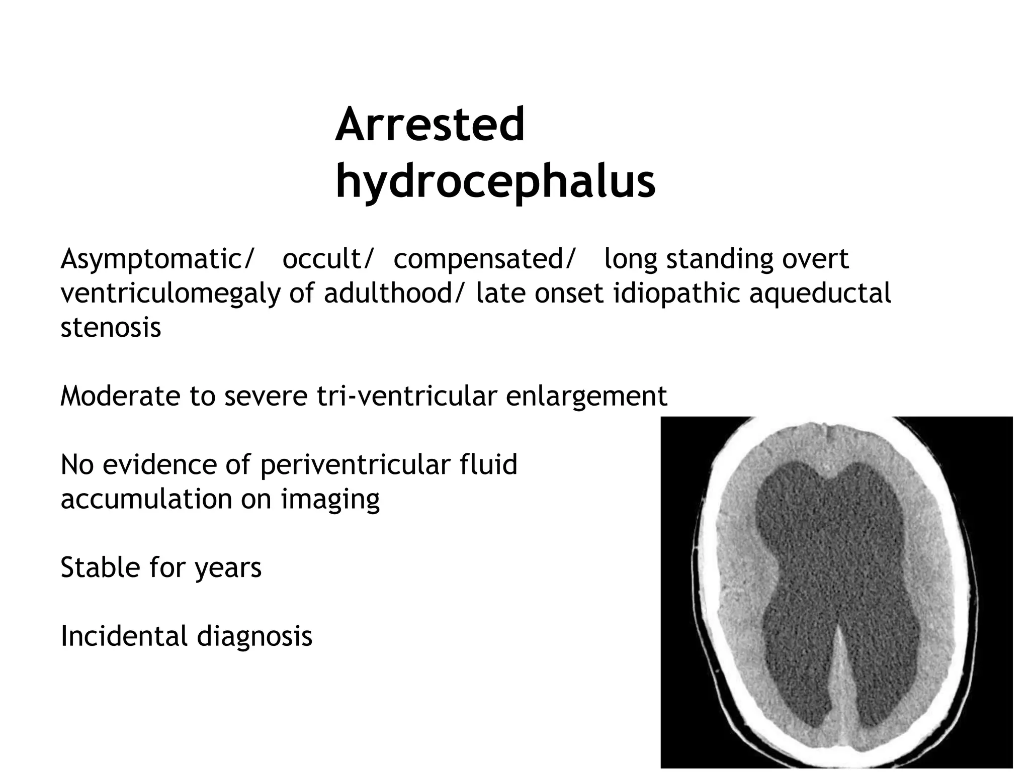 hydrocephalus and csf disorders powerpoint | PPTX