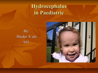 Hydrocephalus
         in Paediatric


    By:
Hieder A`ala
    601




                         1
 