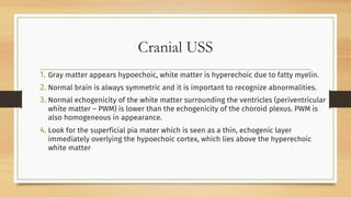 Comprehensive Overview of Hydrocephalus: Pathophysiology, Diagnosis ...
