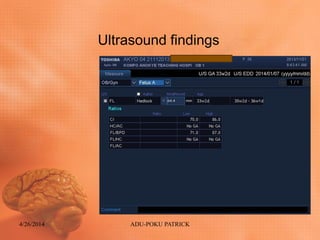Ultrasound findings
4/26/2014 ADU-POKU PATRICK
 