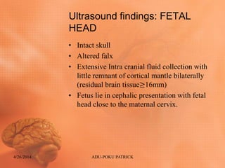 Ultrasound findings: FETAL
HEAD
• Intact skull
• Altered falx
• Extensive Intra cranial fluid collection with
little remnant of cortical mantle bilaterally
(residual brain tissue≥16mm)
• Fetus lie in cephalic presentation with fetal
head close to the maternal cervix.
4/26/2014 ADU-POKU PATRICK
 