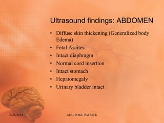 Ultrasound findings: ABDOMEN
• Diffuse skin thickening (Generalized body
Edema)
• Fetal Ascites
• Intact diaphragm
• Normal cord insertion
• Intact stomach
• Hepatomegaly
• Urinary bladder intact
4/26/2014 ADU-POKU PATRICK
 