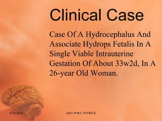 Clinical Case
Case Of A Hydrocephalus And
Associate Hydrops Fetalis In A
Single Viable Intrauterine
Gestation Of About 33w2d, In A
26-year Old Woman.
4/26/2014 ADU-POKU PATRICK
 