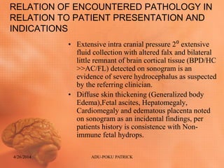RELATION OF ENCOUNTERED PATHOLOGY IN
RELATION TO PATIENT PRESENTATION AND
INDICATIONS
• Extensive intra cranial pressure 2⁰ extensive
fluid collection with altered falx and bilateral
little remnant of brain cortical tissue (BPD/HC
>>AC/FL) detected on sonogram is an
evidence of severe hydrocephalus as suspected
by the referring clinician.
• Diffuse skin thickening (Generalized body
Edema),Fetal ascites, Hepatomegaly,
Cardiomegaly and edematous placenta noted
on sonogram as an incidental findings, per
patients history is consistence with Non-
immune fetal hydrops.
4/26/2014 ADU-POKU PATRICK
 