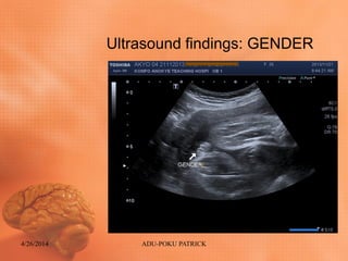 Ultrasound findings: GENDER
4/26/2014 ADU-POKU PATRICK
 