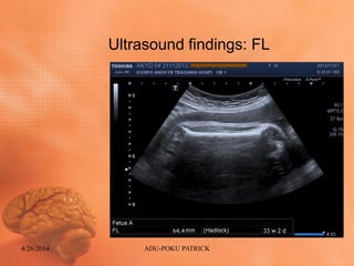 Ultrasound findings: FL
4/26/2014 ADU-POKU PATRICK
 