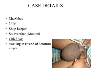 CASE DETAILS
• Mr.Abbas
• 36 M
• Shop keeper
• Solavanthan ,Madurai
• Chief c/o:
• Swelling in Lt side of Scrotum
- 5yrs
 