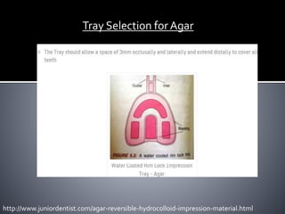 Tray Selection for Agar
http://www.juniordentist.com/agar-reversible-hydrocolloid-impression-material.html
 