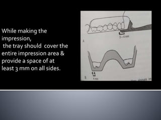 While making the
impression,
the tray should cover the
entire impression area &
provide a space of at
least 3 mm on all sides.
 