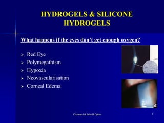 HYDROGELS & SILICONE
HYDROGELS
What happens if the eyes don’t get enough oxygen?
 Red Eye
 Polymegathism
 Hypoxia
 Neovascularisation
 Corneal Edema
Churwan Lal Sahu M Optom 7
 