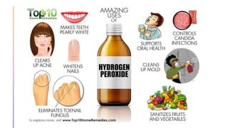 Hydrogen peroxide Project