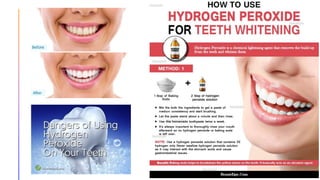 Hydrogen peroxide Project