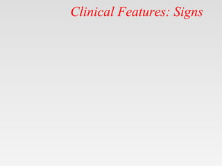 Clinical Features: Signs
 