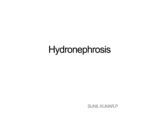 Hydronephrosis
SUNILKUMAR.P
 