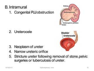 B.Intramural
1. Congenital PUJobstruction
2. Ureterocele
3. Neoplasm of ureter
4. Narrow ureteric orifice
5. Stricture ureter following removal of stone,pelvic
surgeries or tuberculosis of ureter.
8/18/2013 Hydronephrosis -Intro 10
 