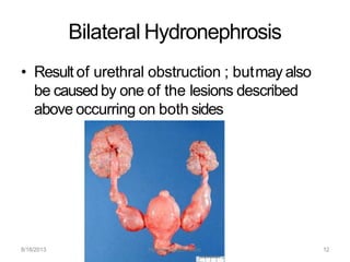 Bilateral Hydronephrosis
• Result of urethral obstruction ; butmay also
be causedby one of the lesions described
above occurring on both sides
8/18/2013 Hydronephrosis -Intro 12
 