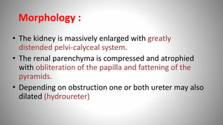 • The kidney is massively enlarged with greatly
distended pelvi-calyceal system.
• The renal parenchyma is compressed and atrophied
with obliteration of the papilla and fattening of the
pyramids.
• Depending on obstruction one or both ureter may also
dilated (hydroureter)
Morphology :
 