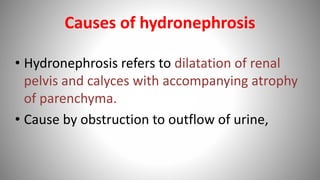 Causes of hydronephrosis
• Hydronephrosis refers to dilatation of renal
pelvis and calyces with accompanying atrophy
of parenchyma.
• Cause by obstruction to outflow of urine,
 