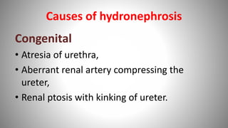 Causes of hydronephrosis
Congenital
• Atresia of urethra,
• Aberrant renal artery compressing the
ureter,
• Renal ptosis with kinking of ureter.
 