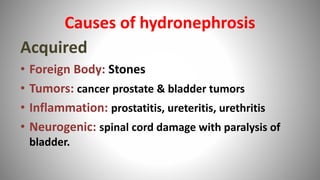 Causes of hydronephrosis
Acquired
• Foreign Body: Stones
• Tumors: cancer prostate & bladder tumors
• Inflammation: prostatitis, ureteritis, urethritis
• Neurogenic: spinal cord damage with paralysis of
bladder.
 