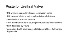 Posterior Urethral Valve
• MC urethral obstructive lesions in newborn males
• MC cause of bilateral hydronephrosis in male fetuses
• Seen in distal prostatic urethra
• Thin membranous folds causing obstruction to unine outflow
• First described by Young
• Assosciated with other congenital abnormalities - Pulmonary
hypoplasia
 