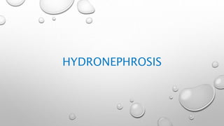 HYDRONEPHROSIS
 