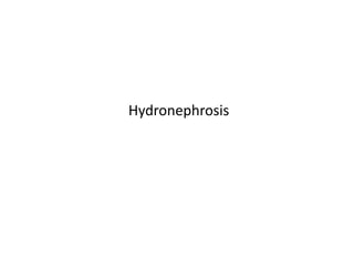 Hydronephrosis
 