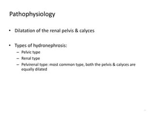 Pathophysiology
• Dilatation of the renal pelvis & calyces
• Types of hydronephrosis:
– Pelvic type
– Renal type
– Pelvirenal type: most common type, both the pelvis & calyces are
equally dilated
17
 