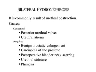 BILA
TERALHYDRONEPHROSIS
It iscommonly result of urethral obstruction.
Causes:
Congenital
 Posterior urethral valves
 Urethral atresia
Acquired
 Benign prostatic enlargement
 Carcinoma of the prostate
 Postoperative bladder neck scarring
 Urethral stricture
 Phimosis
 