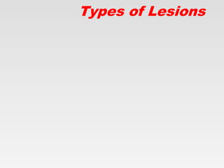 Types of Lesions
 