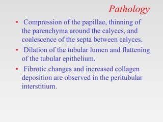 Pathology
• Compression of the papillae, thinning of
the parenchyma around the calyces, and
coalescence of the septa between calyces.
• Dilation of the tubular lumen and flattening
of the tubular epithelium.
• Fibrotic changes and increased collagen
deposition are observed in the peritubular
interstitium.
 