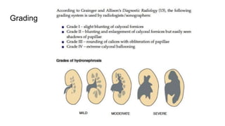 Hydronephrosis.pptx