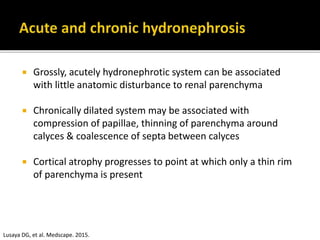  Grossly, acutely hydronephrotic system can be associated
with little anatomic disturbance to renal parenchyma
 Chronically dilated system may be associated with
compression of papillae, thinning of parenchyma around
calyces & coalescence of septa between calyces
 Cortical atrophy progresses to point at which only a thin rim
of parenchyma is present
Lusaya DG, et al. Medscape. 2015.
 