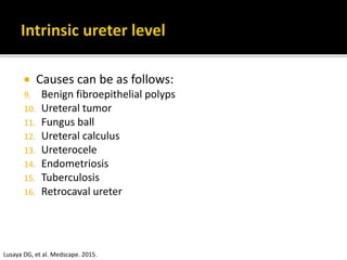  Causes can be as follows:
9. Benign fibroepithelial polyps
10. Ureteral tumor
11. Fungus ball
12. Ureteral calculus
13. Ureterocele
14. Endometriosis
15. Tuberculosis
16. Retrocaval ureter
Lusaya DG, et al. Medscape. 2015.
 