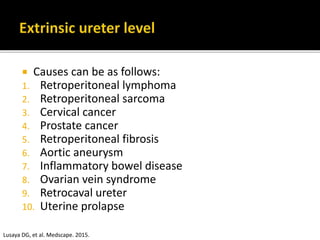  Causes can be as follows:
1. Retroperitoneal lymphoma
2. Retroperitoneal sarcoma
3. Cervical cancer
4. Prostate cancer
5. Retroperitoneal fibrosis
6. Aortic aneurysm
7. Inflammatory bowel disease
8. Ovarian vein syndrome
9. Retrocaval ureter
10. Uterine prolapse
Lusaya DG, et al. Medscape. 2015.
 