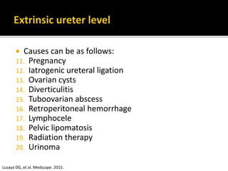  Causes can be as follows:
11. Pregnancy
12. Iatrogenic ureteral ligation
13. Ovarian cysts
14. Diverticulitis
15. Tuboovarian abscess
16. Retroperitoneal hemorrhage
17. Lymphocele
18. Pelvic lipomatosis
19. Radiation therapy
20. Urinoma
Lusaya DG, et al. Medscape. 2015.
 