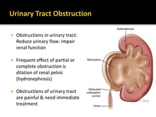  Obstructions in urinary tract:
Reduce urinary flow: Impair
renal function
 Frequent effect of partial or
complete obstruction is
dilation of renal pelvic
(hydronephrosis)
 Obstructions of urinary tract
are painful & need immediate
treatment
 