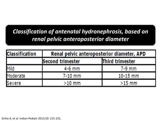 Classification of antenatal hydronephrosis, based on
renal pelvic anteroposterior diameter
Sinha A, et al. Indian Pediatr 2013;50: 215-231.
 