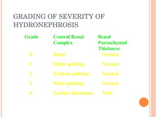 Hydronephrosis Dr Lokku | PPT