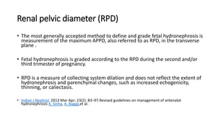 Renal pelvic diameter (RPD)
• The most generally accepted method to define and grade fetal hydronephrosis is
measurement of the maximum APPD, also referred to as RPD, in the transverse
plane .
• Fetal hydronephrosis is graded according to the RPD during the second and/or
third trimester of pregnancy.
• RPD is a measure of collecting system dilation and does not reflect the extent of
hydronephrosis and parenchymal changes, such as increased echogenicity,
thinning, or caliectasis.
• Indian J Nephrol. 2013 Mar-Apr; 23(2): 83–97.Revised guidelines on management of antenatal
hydronephrosis A. Sinha, A. Bagga,et al.
 