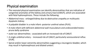 Physical examination
• The neonatal physical examination can identify abnormalities that are indicative of
congenital anomalies of the kidney and urinary tract (CAKUT), which are associated
with fetal hydronephrosis. These include the following:
• Abdominal mass - enlarged kidney due to obstructive uropathy or multicystic
dysplastic kidney
• A palpable bladder in a male infant- posterior urethral valves (PUV).
• A male infant with deficient abdominal wall musculature and undescended testes-
prune-belly syndrome
• outer ear abnormalities - associated with an increased risk of CAKUT.
• A single umbilical artery - increased risk of CAKUT, particularly vesicoureteral reflux
(VUR).
• Spinal and/or lower extremity abnormalities suggesting a neurogenic bladder, which
may result in hydronephrosis and dilated ureters
 