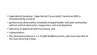 • Eagle-Barrett Syndrome - Eagle-Barrett (“prune belly”) syndrome (EBS) is
characterized by a triad of
• genitourinary abnormalities (markedly enlarged bladder with poor contractility
without urethral obstruction, megaureters, and renal dysplasia),
• deficiency of abdominal wall musculature, and
• cryptorchidism .
• The estimated incidence is 1 in 35,000-50,000 live births, with more than 95% of
the cases occurring in boys.
 