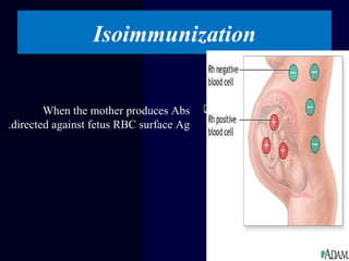 When the mother produces Abs
directed against fetus RBC surface Ag.
Isoimmunization
 