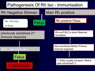 Rh Negative Women Man Rh positive
⇓
Fetus
Rh positive Fetus
→
Rh+ve R.B.C.s enter Maternal
circulation⇐
previously sensitized 2nd
immune response
IgM…IgG antibodies
⇓
Non sensitized Mother Primary
immune response
1st
Baby usually escapes. Mother
gets sensitized? ±
Fetus
Haemolysis
⇓
Pathogenesis Of Rh Iso - immunisation
Rh –VE Fetus
no harm
 